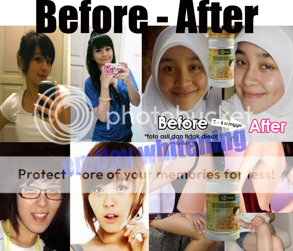 before-after-emilay.jpg